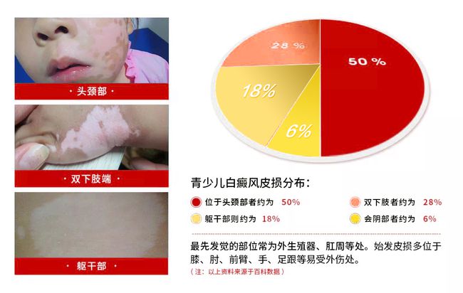 白癜风新疗法探索之旅，与自然美景交融，寻求内心宁静与平和之道